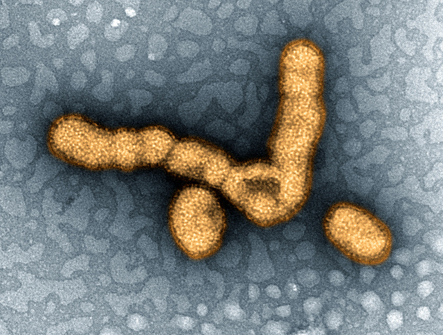 H1N1, Swine Flu, or "That Conspiracy to Market Tamiflu" | Photo: NIAID, CC BY 2.0